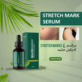 Markaway Stretch Mark Serum 30ml Anti-Aging Hydrating