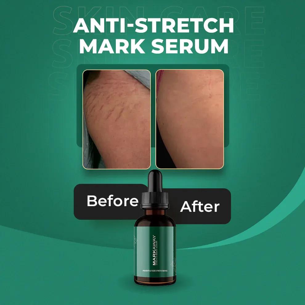 Markaway Stretch Mark Serum 30ml Anti-Aging Hydrating